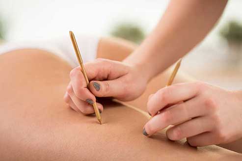 akupunkt massage